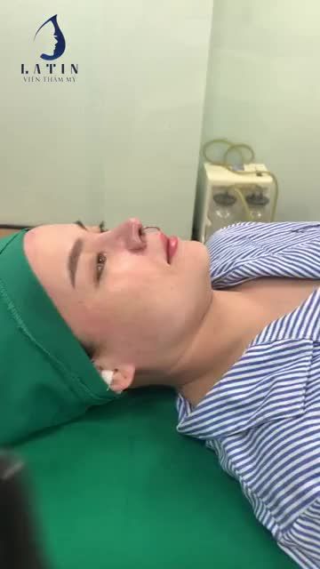 Mời cả nhà cùng xem livestream để chiêm ngưỡng dáng mũi 100 điểm nhé!