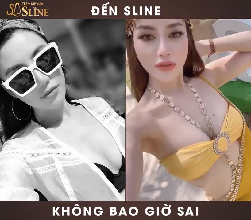 Quá đơn giản với dịch vụ tư vấn nâng cấp vòng 1, sau 60 phút bạn sẽ lột xác hoàn toàn với bầu n.gực căng tròn, làm “mòn” biết bao con mắt.