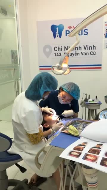 GẮN NIỀNG RĂNG MẮC CÀI KIM LOẠI THƯỜNG TẠI NHA KHOA PARIS VINH (NGHỆ AN)