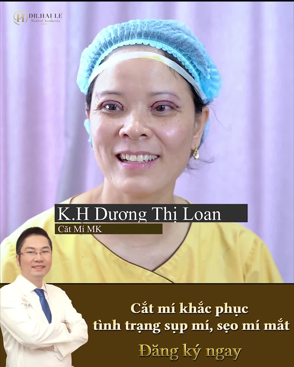 Mặc cảm từ bé vì 2 mí không đều, 1 bên nếp mí bị sẹo