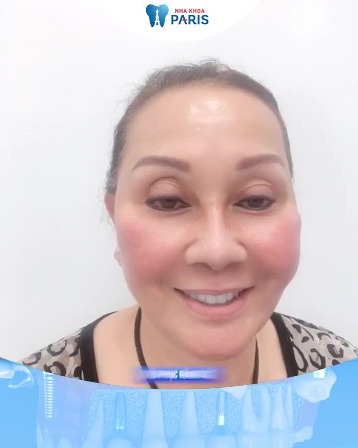 Trồng răng Implant Chọn bảo hành trọn đời
