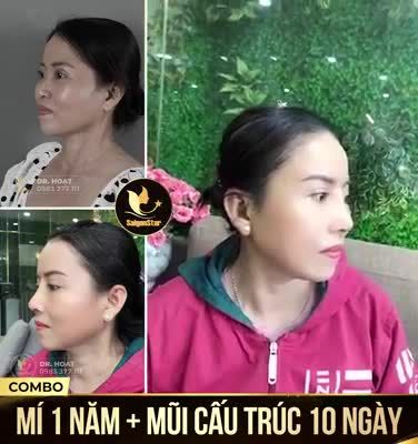 COMBO MÍ 1 NĂM - MŨI CẤU TRÚC 10 NGÀY