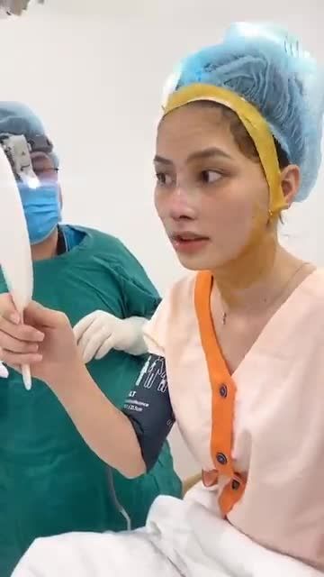 Dáng mũi Sline cao cho khách hàng đến từ Kiên Giang