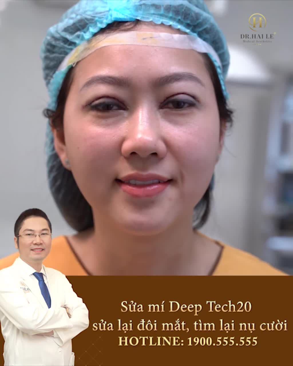 SỬA LẠI ĐÔI MẮT - TÌM LẠI NỤ CƯỜI VỚI KỸ THUẬT DEEP TECH20