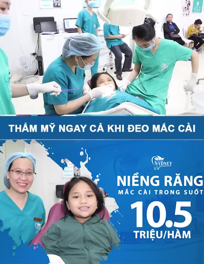 NIỀNG RĂNG THÍCH MÊ CÙNG MẮC CÀI PHA LÊ
