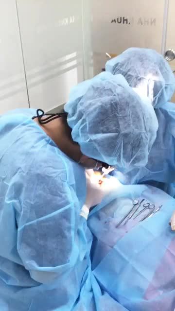 CẮM 4 TRỤ IMPLANT CHO KHÁCH HÀNG TẠI NHA KHOA PARIS BÌNH DƯƠNG