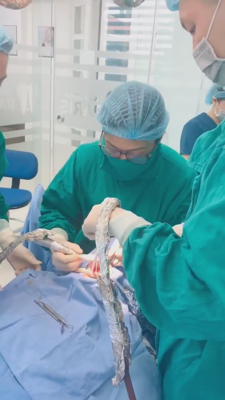 TS.BS ĐÀM NGỌC TRÂM THỰC HIỆN CẮM 8 TRỤ IMPLANT TẠI NHA KHOA PARIS 39 QUANG TRUNG