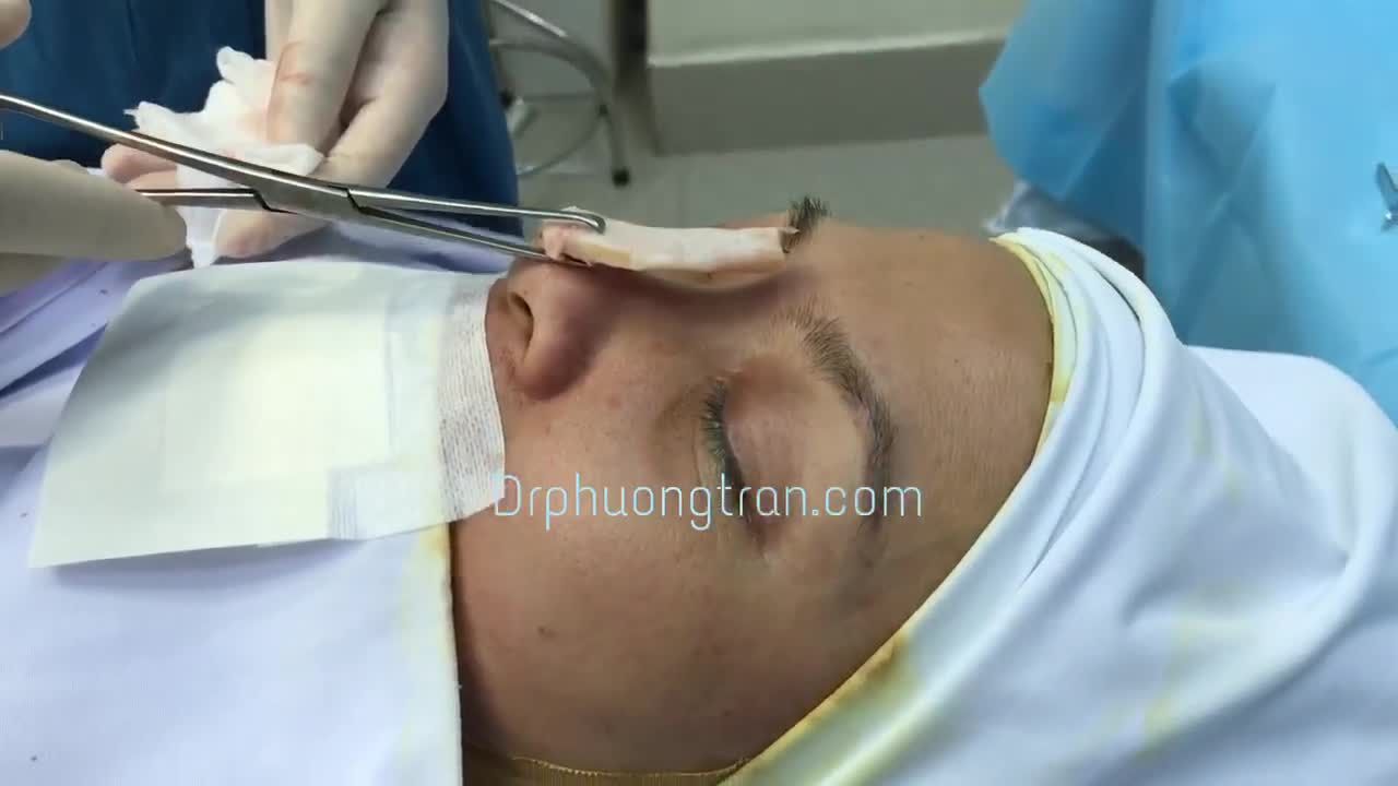 100% CA PHẪU THUẬT ĐƯỢC QUAY PHIM LẠI ĐỂ TRẢ CHO KHÁCH HÀNG.THAY LỜI CAM KẾT MINH BẠCH DỊCH VỤ