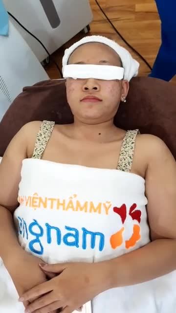 Quy trình chiếu đèn Nanoskin tái tạo lại da sau khi lấy nhân mụn