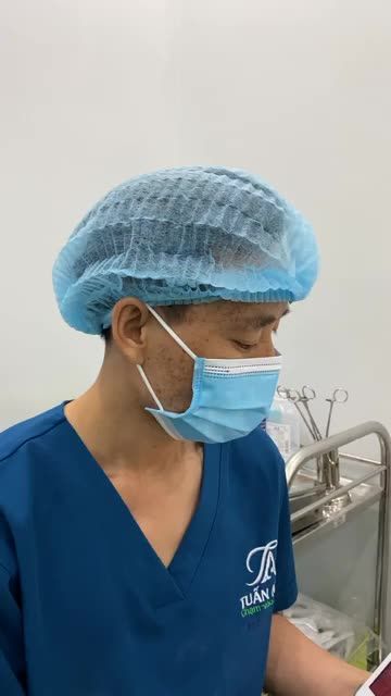 CẮT MÍ TRÊN - CẮT MÍ DƯỚI
