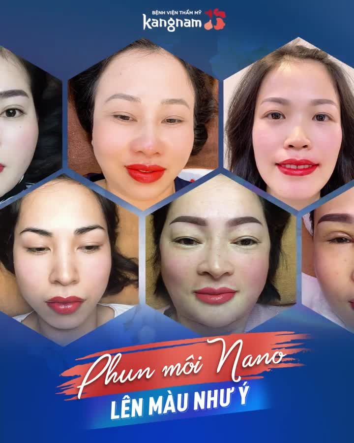 Kết quả mĩ mãn của các nàng phun môi Nano tại Kangnam Nhìn là nghiện