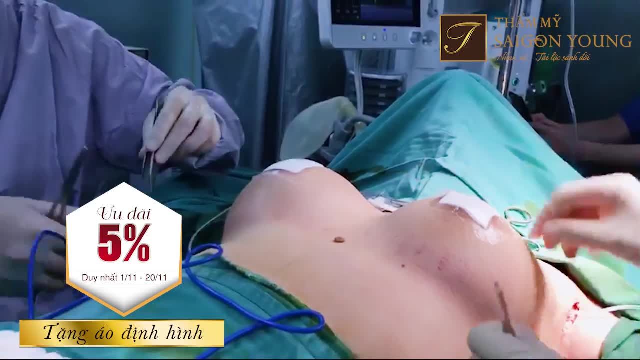 Ngày đẹp trời chiêm ngưỡng kết quả nâng cấp V1 đẹp đến từ