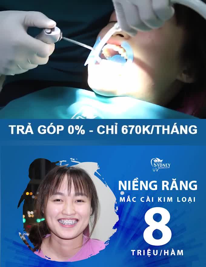 NIỀNG RĂNG ĐÚNG Ý CHẲNG NGẠI CHI PHÍ