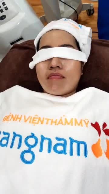 Quy trình chiếu đèn sau khi lấy nhân mụn giúp se khít lỗ chân lông và làm sáng da của khách hàng lần thứ 3.