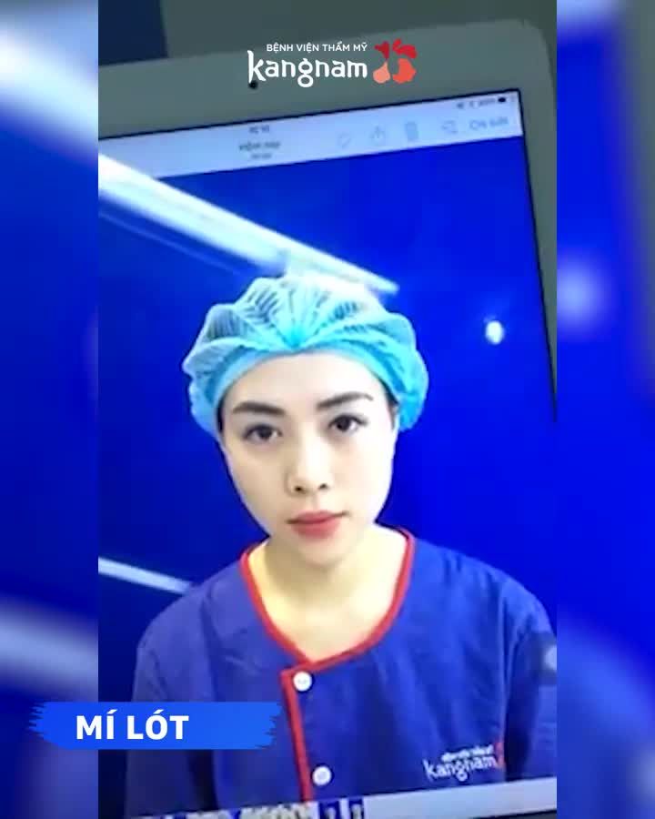Mắt mí lệch Mí to Mí nhỏ