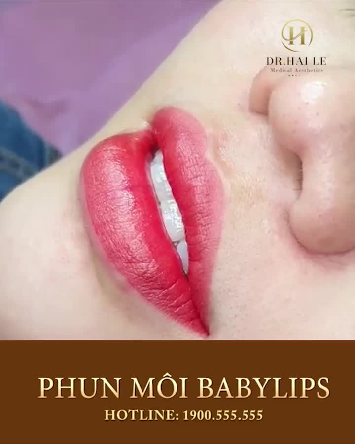 VÌ SAO DR.HẢI LÊ LUÔN POST HÌNH MÔI KHÔ VÀ KHÔNG BÓNG BẨY
