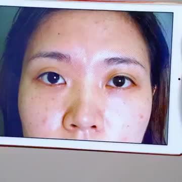Lý giải vì sao các phương pháp Thẩm mỹ mắt và các Bác sĩ tại Dr.Hải Lê được nhiều khách hàng tin tưởng "Chọn mặt gửi vàng"