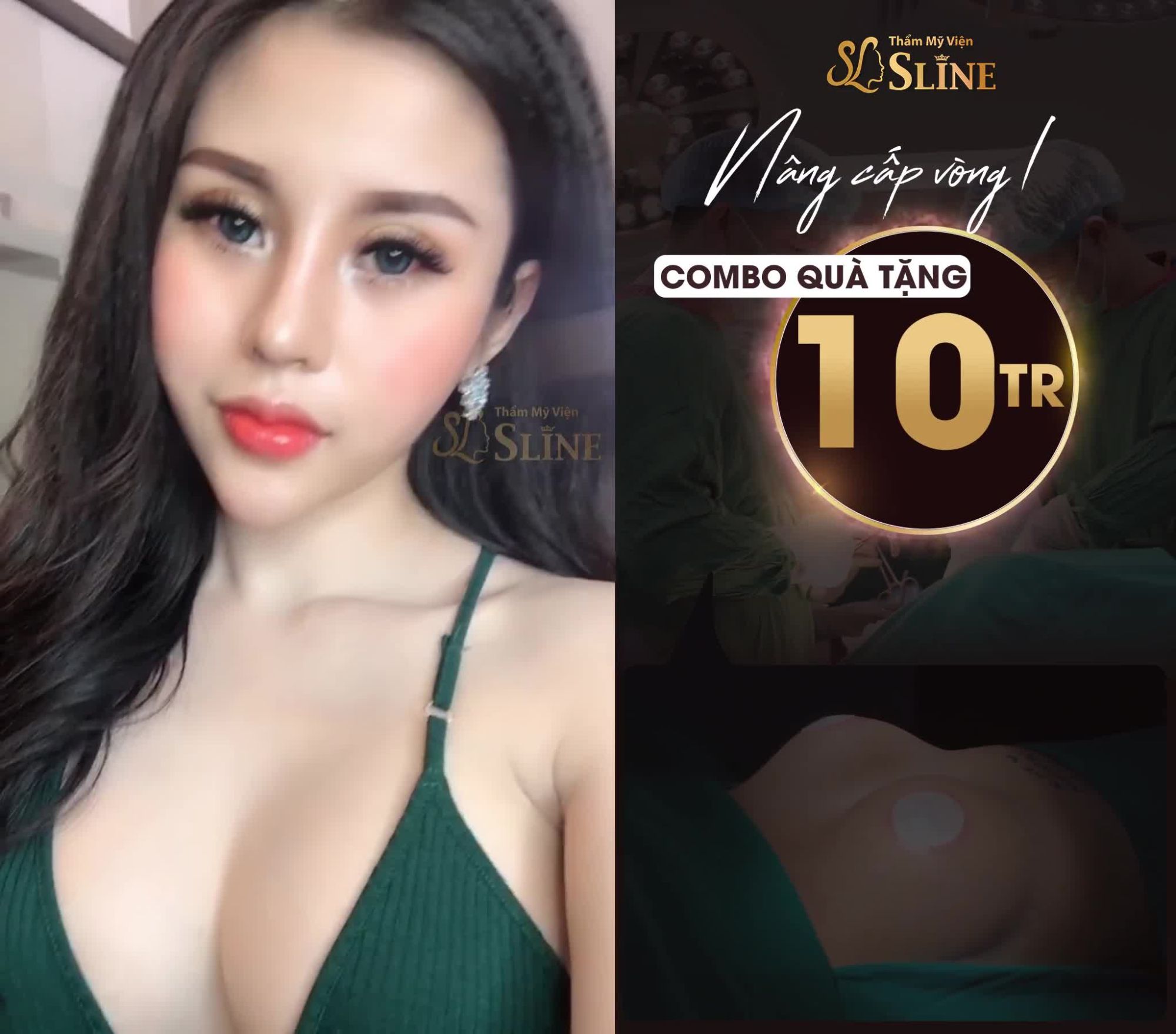 VÒNG 1 NỞ NANG - NHẬN NGÀN ƯU ĐÃI