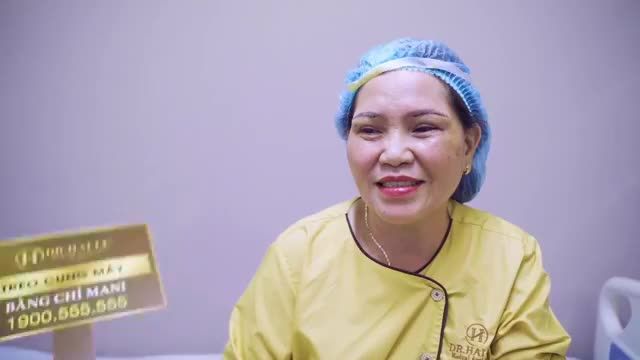Cùng nghe vị khách hàng U50+ chia sẻ kinh nghiệm Nâng cung mày giải thoát khỏi nếp mí u buồn, da chùng nặng mắt, che khuất tầm nhìn suốt 10 năm