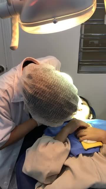 Case gắn mắc cài