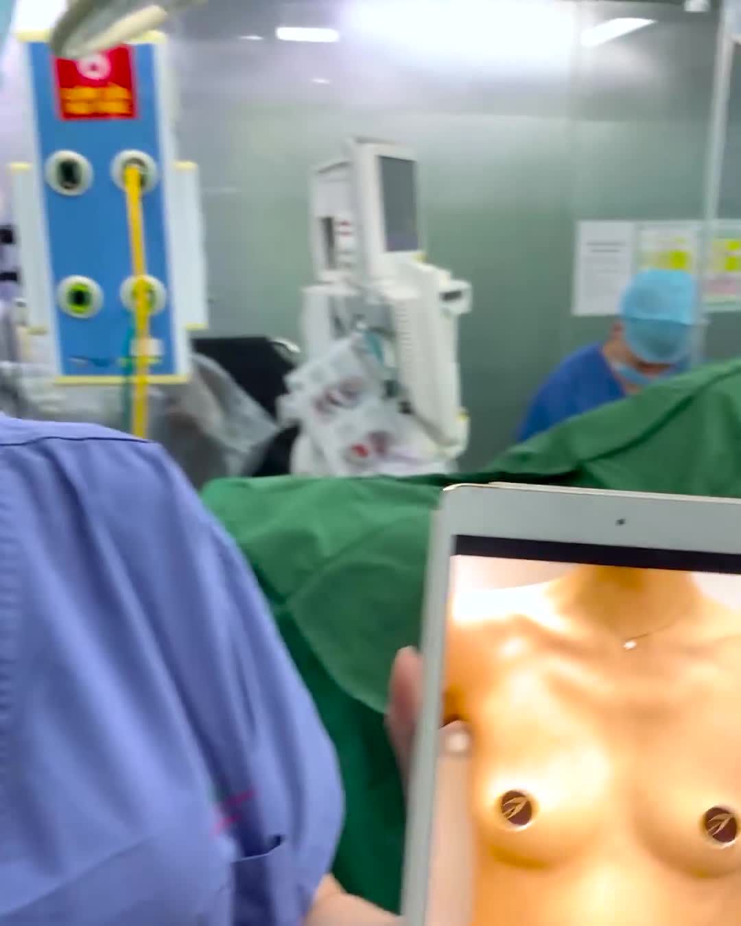 Kết quả sau Phẫu thuật nâng V1 Thẩm mỹ Saigon Young  Bác sĩ Dương Văn Tươi