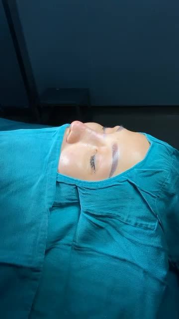 NÂNG MŨI CẤU TRÚC SOFTXIL - CỨU TINH CHO DÁNG MŨI XINH