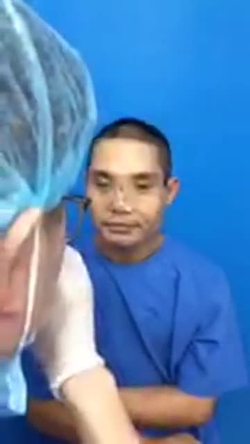 MŨI  MẮT biến dạng sau tai nạn, trường hợp này sẽ khắc phục như thế nào? Dịch vụ gì phù hợp??