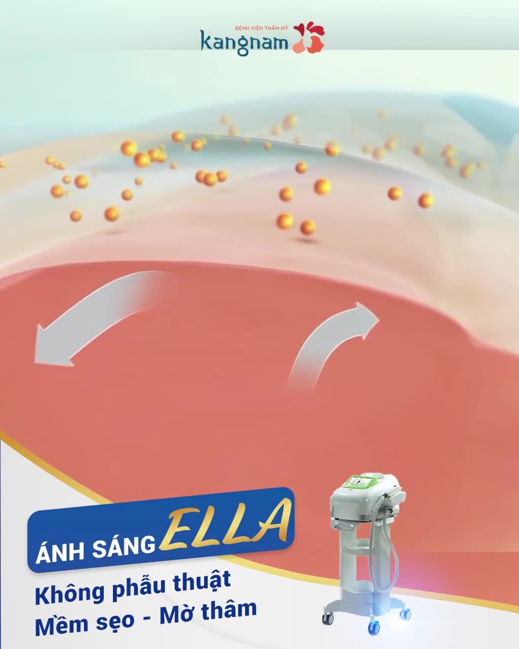 Trị sẹo Ella thách thức mọi kích thước, tình trạng sẹo lồi