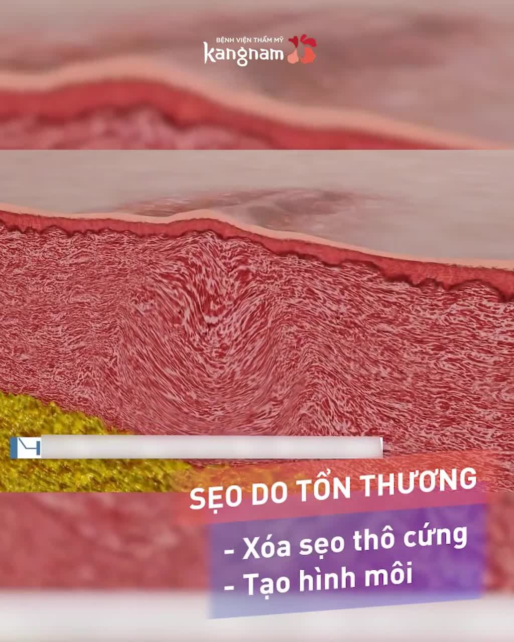 Tạm biệt MÔI SẸO - HỞ HÀM ẾCH
