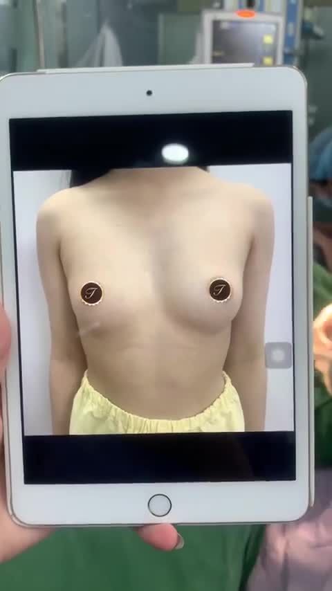 VÒNG 1 PHỔNG PHAO BAO NÀNG MƠ ƯỚC