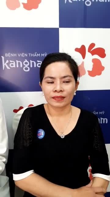 Khách hàng thực hiện dịch vụ CẮT MÍ TRÊN PLASMA NÂNG MŨI SLINE 4D CHỈNH XƯƠNG CẮT CÁNH MŨI sau 10 ngày phẫu thuật