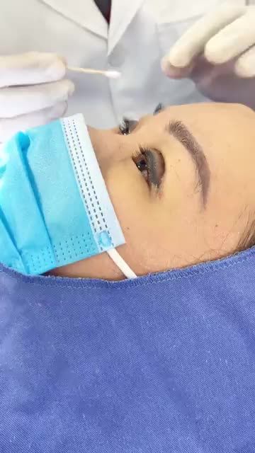 Chỉ 5 NGÀY sau CẮT MÍ: Đã cắt chỉ được ngay KHÔNG ĐAU