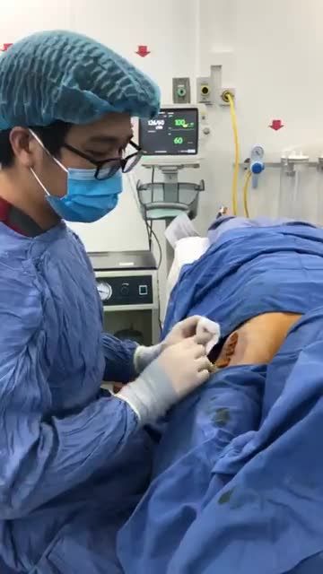 Có ai thắc mắc sau khi hút tuyến sẽ thực hiện quy trình như thế nào không ạ ???