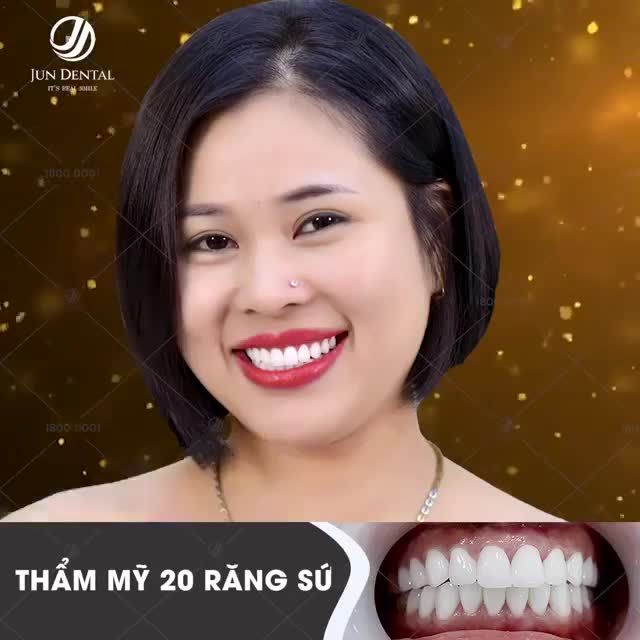 BẮT TRỌN XU HƯỚNG THẨM MỸ VỚI NHỮNG DÒNG SỨ CAO CẤP HÀNG ĐẦU TẠI JUN DENTAL