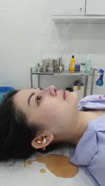 GIAO LƯU VỚI BẠN GÁI XINH ĐẸP VỪA NÂNG MŨI XONG