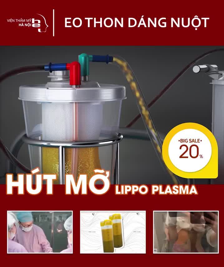 Mô phỏng công nghệ Hút mỡ lipo plasma hiện đại của Viện thẩm mỹ Hà Nội.