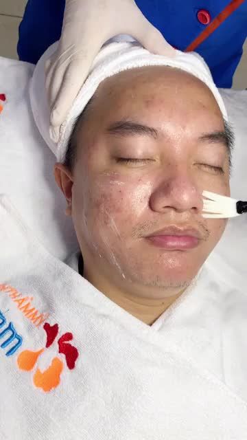 Muốn trị mụn hiệu quả, phải làm gì?