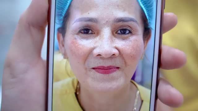 Nâng cung mày "giải pháp" khắc phục mắt sụp mí, xóa sổ da mí chùng nhăn nheo. ĐỪNG BỎ LỠ!