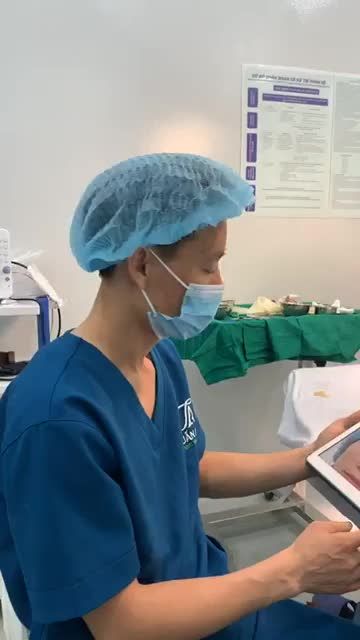 NÂNG MŨI S-Line - THU GỌN CÁNH MŨI
