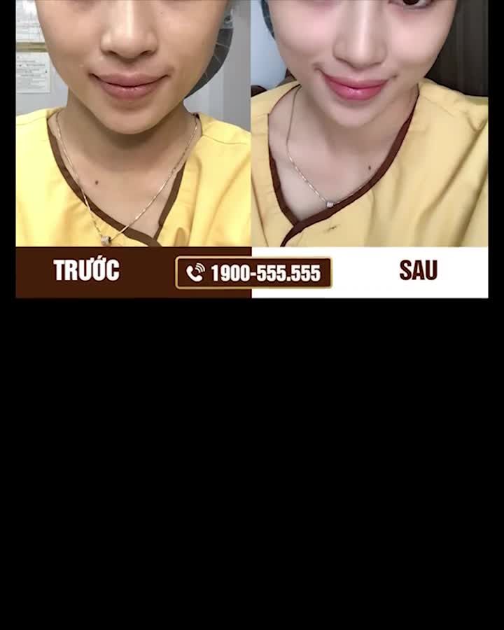 Cơ hội Thẩm mỹ mắt với chi phí 0 ĐỒNG. NHANH TAY KẺO LỠ!