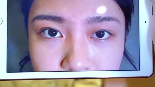 Mắt bạn dù nhiều khuyết điểm như thế nào Dr.Hải Lê đều có thể xử lý và mang đến vẻ đẹp tươi trẻ rạng ngời, cân xứng cho bạn