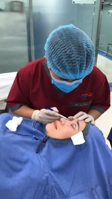 Quá trình cắt mí không đau mí đều đẹp tại Kangnam