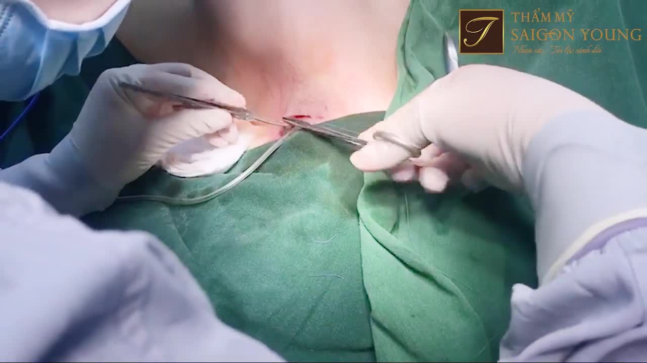 37 tuổi mang nhiều tâm tư, chị khách hàng đến gặp bác sĩ Tươi để chia sẻ câu chuyện và mong muốn thay đổi V1 "xuống cấp" trầm trọng sau sinh của mình.