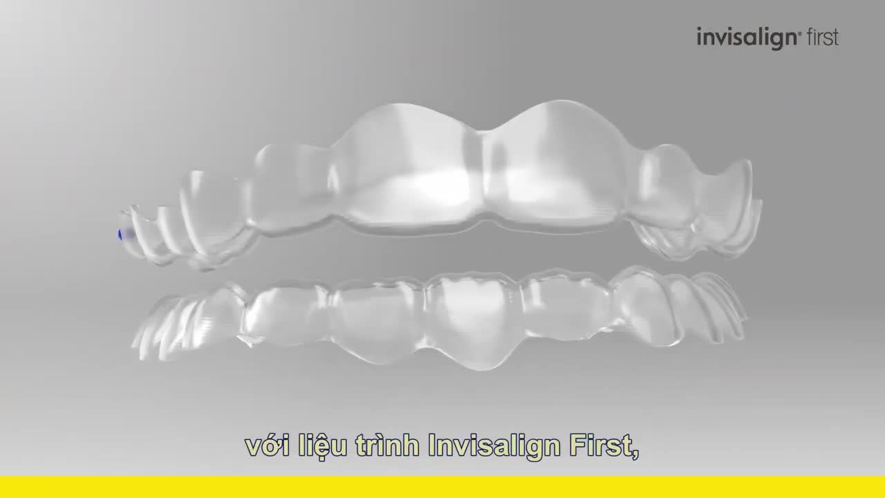 INVISALIGN - BƯỚC ĐẦU TIÊN CHO BÉ NỤ CƯỜI HOÀN THIỆN
