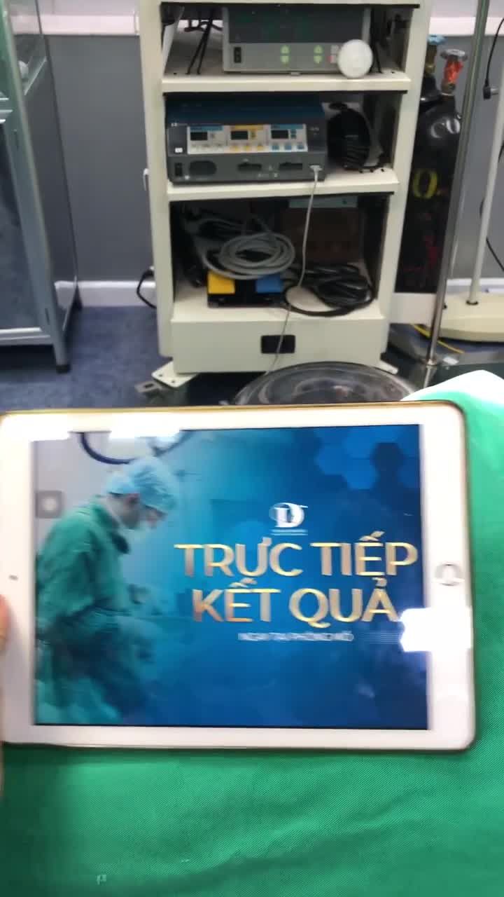 Team teo lép nên theo dõi Livestream này.