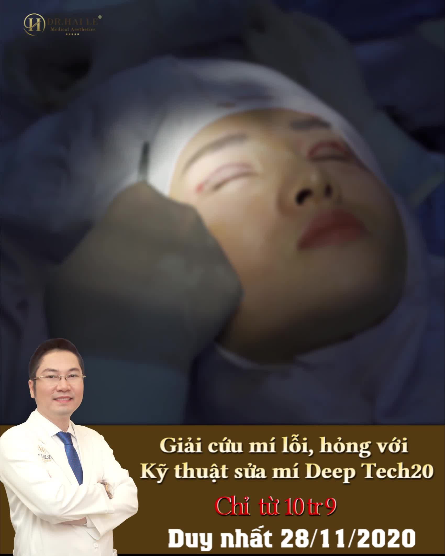 Mí khó, lỗi, hỏng cấp độ nào? VTM Dr.Hải Lê cũng có thể sửa lại được.