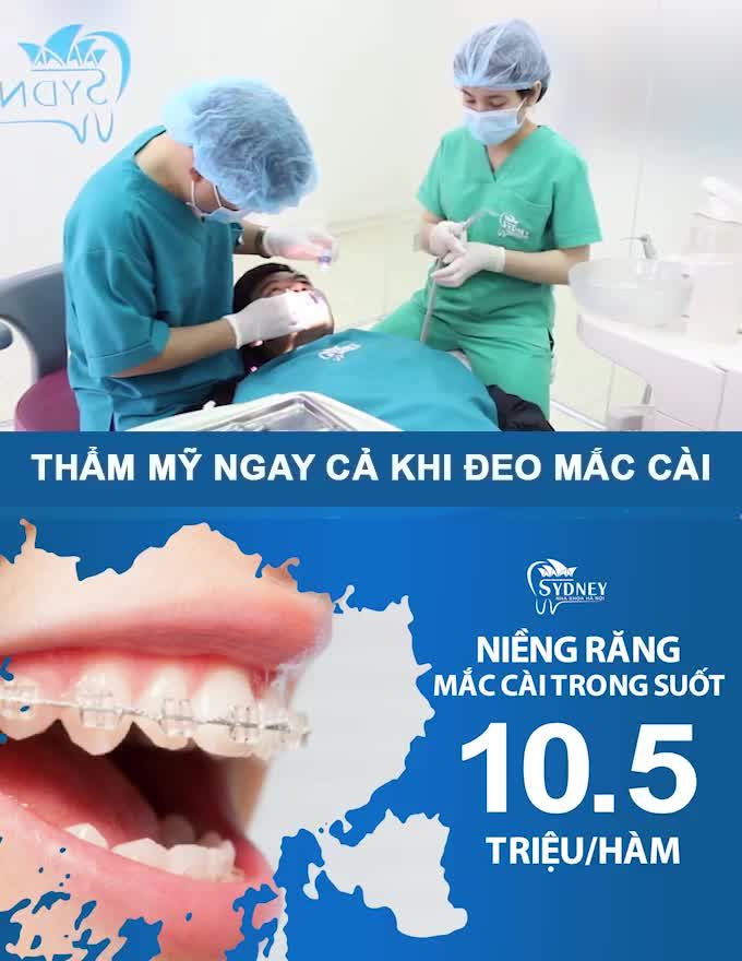 NIỀNG RĂNG CÓ BỊ SÂU RĂNG KHÔNG