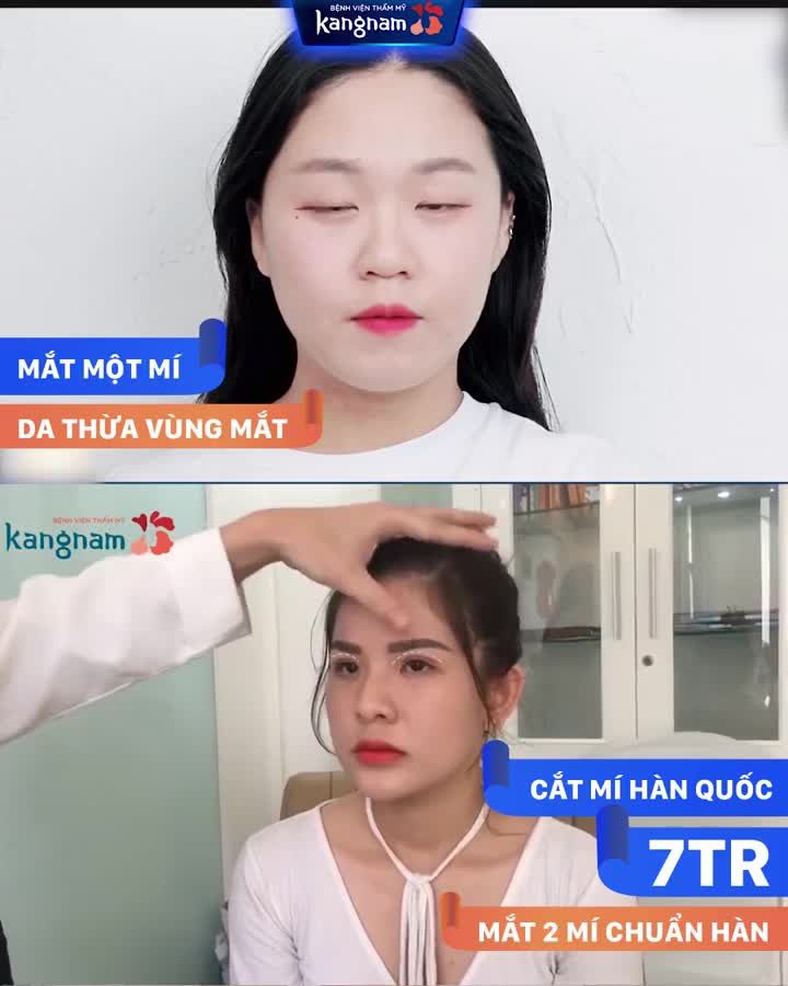 Mắt đẹp tối đa Chi phí tối thiểu