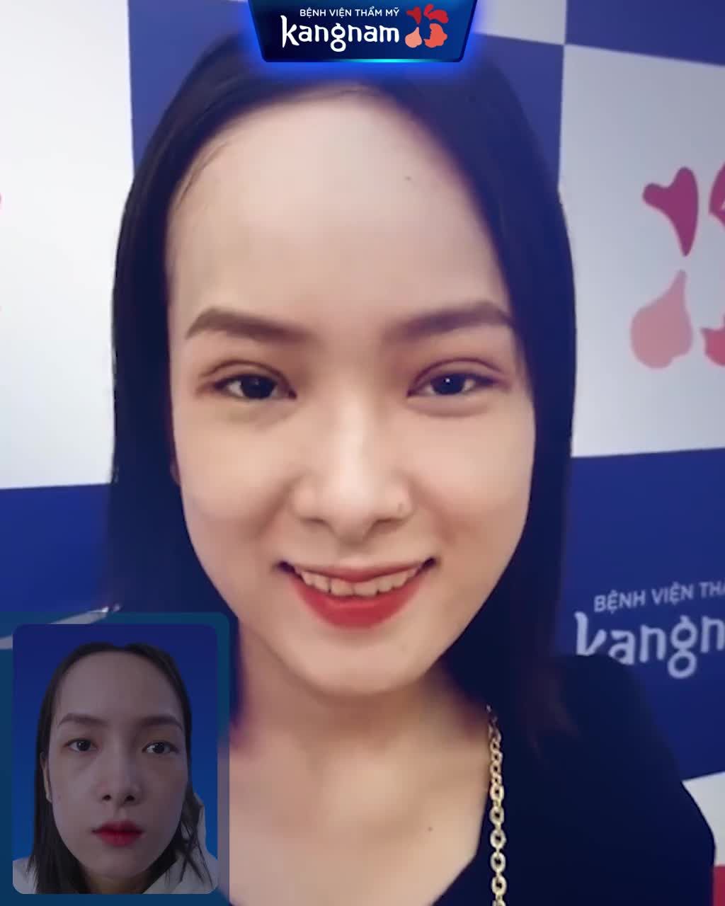 Cắt mí đã thay đổi khách hàng của Kangnam thế nào?