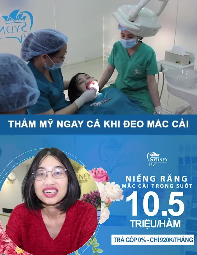 LỢI ÍCH CỦA NIỀNG RĂNG CÓ THỂ BẠN KHÔNG BIẾT